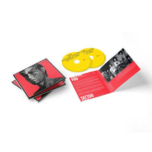 Load image into Gallery viewer, Rolling Stones, The - Tattoo You (40th Anniversary)